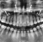 Teeth Imaging