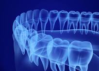 Teeth Imaging